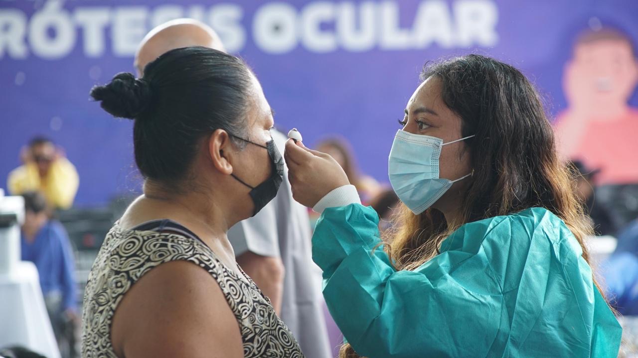 Concluye 20ª Jornada de Prótesis Ocular; benefician a 143 personas